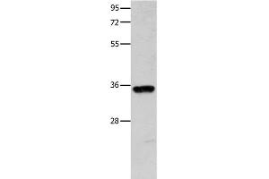Western Blot analysis of Mouse brain tissue using COX11 Polyclonal Antibody at dilution of 1:600 (COX11 Antikörper)