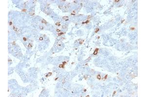 Formalin-fixed, paraffin-embedded human Colon stained with MUC2 Rabbit Recombinant Monoclonal Antibody (MLP/2970R). (Rekombinanter MUC2 Antikörper)
