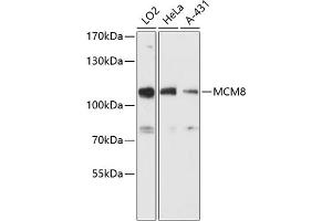 Western blot analysis of extracts of various cell lines, using MCM8 antibody (ABIN6129652, ABIN6143648, ABIN6143649 and ABIN6216734) at 1:3000 dilution. (MCM8 Antikörper  (AA 591-840))