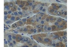 Immunohistochemistry (IHC) image for anti-Matrix Metallopeptidase 7 (Matrilysin, Uterine) (MMP7) (AA 1-267) antibody (ABIN7431020)