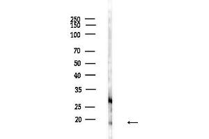 Western blot analysis of lysates from F10-LUC cells(heat-shock,45 min treatment), using EIF5 Antibody at 1/1000 dilution.