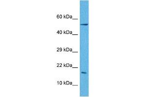 Host:  Rabbit  Target Name:  LEP  Sample Tissue:  Human A549 Whole Cell  Antibody Dilution:  1ug/ml (Leptin Antikörper  (N-Term))