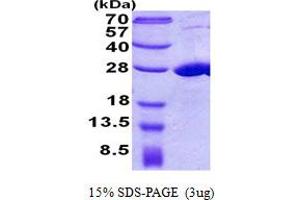 SDS-PAGE (SDS) image for COMM Domain Containing 7 (COMMD7) (AA 1-200) protein (His tag) (ABIN5852998)