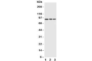 Western blot testing of CDC5L antibody and Lane 1:  HeLa;  2: Raji;  3: A549 cell lysate. (CDC5L Antikörper  (C-Term))