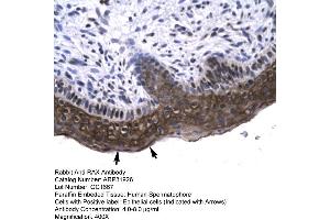 Human Spermatophore (RAX Antikörper  (N-Term))