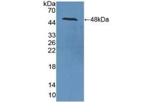 Detection of Recombinant NSE, Rat using Polyclonal Antibody to Enolase, Neuron Specific (NSE)