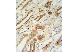 ZFYVE16 Antibody (N-term) (ABIN651313 and ABIN2840182) IHC analysis in formalin fixed and paraffin embedded lung tissue followed by peroxidase conjugation of the secondary antibody and DAB staining. (ZFYVE16 Antikörper  (N-Term))