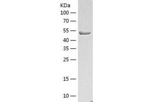 NOVA1 Protein (AA 2-507) (His tag)