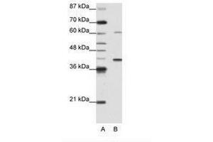 Image no. 1 for anti-Zinc Finger Protein 843 (ZNF843) (AA 41-90) antibody (ABIN6736171)