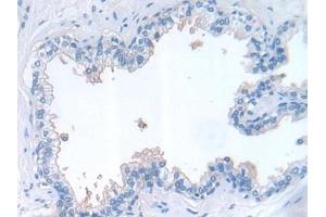 Immunohistochemistry (IHC) image for anti-Leukemia Inhibitory Factor (LIF) (AA 2-201) antibody (ABIN7430882)