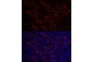 Immunofluorescence analysis of mouse kidney cells using  Rabbit pAb (ABIN3016811, ABIN3016812, ABIN3016813, ABIN1678723 and ABIN6219847) at dilution of 1:150 (40x lens). (AQP3 Antikörper  (AA 178-292))