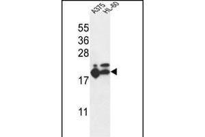 RPL17 Antibody (C-term) (ABIN653848 and ABIN2843111) western blot analysis in ,HL-60 cell line lysates (35 μg/lane). (RPL17 Antikörper  (C-Term))