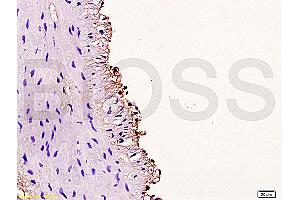 Formalin-fixed and paraffin embedded rabbit carotid artery labeled Anti-Cyclin D3 Polyclonal Antibody, Unconjugated (ABIN671571) at 1:200, followed by conjugation to the secondary antibody and DAB staining (Cyclin D3 Antikörper  (AA 121-220))