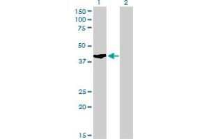 Western Blot analysis of SHOX2 expression in transfected 293T cell line by SHOX2 monoclonal antibody (M01), clone 1D1.