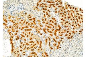 ABIN6262231 and ABIN6279482 at 1/100 staining Rat kidney tissue by IHC-P.