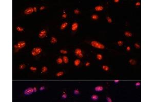 Immunofluorescence analysis of U-2 OS cells using ILF3 Polyclonal Antibody at dilution of 1:100. (Interleukin enhancer-binding factor 3 (ILF3) Antikörper)