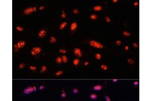 Immunofluorescence analysis of U-2 OS cells using ILF3 Polyclonal Antibody at dilution of 1:100.