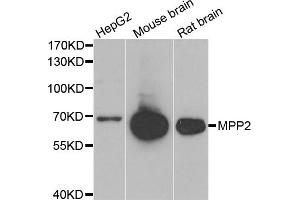 Western blot analysis of extracts of various cell lines, using MPP2 antibody. (MPP2 Antikörper)