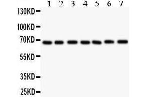 Anti- GAD67 antibody,  Western blotting All lanes: Anti GAD67() at 0.