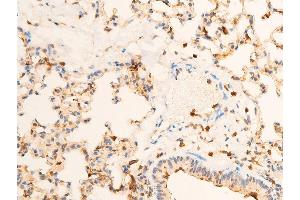 ABIN6267286 at 1/100 staining mouse lung tissue sections by IHC-P. (TRKA Antikörper  (pTyr681, Tyr680))