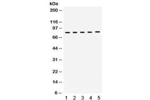 Western blot testing of 1) rat brain, 2) rat testis, 3) mouse brain, 4) mouse testis, 5) human MCF7 lysate with KIF3A antibody.