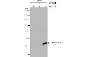 WB Image Annexin II antibody detects Annexin II protein by western blot analysis. (Annexin A2 Antikörper)