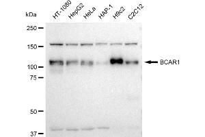 Western blotting analysis using BCAR1 antibody (ABIN7797791). (Rekombinanter BCAR1 Antikörper)
