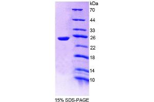 SDS-PAGE (SDS) image for Protein Tyrosine Phosphatase, Receptor Type, U (PTPRU) (AA 1263-1446) protein (His tag) (ABIN6239277)