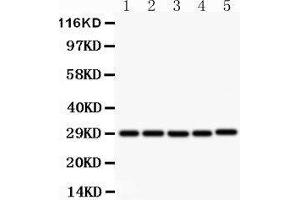 Anti- CD40Lantibody, Western blotting All lanes: Anti CD40L  at 0.