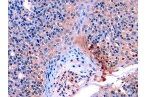 Immunohistochemistry (IHC) image for anti-Matrix Metallopeptidase 9 (Gelatinase B, 92kDa Gelatinase, 92kDa Type IV Collagenase) (MMP9) (AA 213-399) antibody (ABIN7428626)