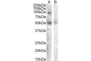 Image no. 1 for anti-Sulfatase 2 (SULF2) (Internal Region) antibody (ABIN375090) (SULF2 Antikörper  (Internal Region))