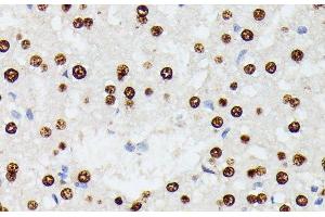 Immunohistochemistry of paraffin-embedded Rat liver using HNRNPD Polyclonal Antibody at dilution of 1:100 (40x lens). (HNRNPD/AUF1 Antikörper)