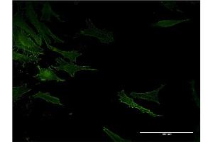 Immunofluorescence of monoclonal antibody to ACE on HeLa cell. (Angiotensin I Converting Enzyme 1 Antikörper  (AA 592-701))