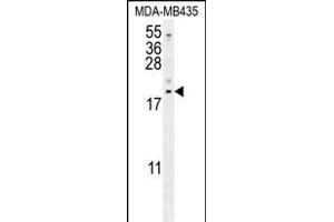 LYRM4 Antibody (Center) (ABIN654638 and ABIN2844335) western blot analysis in MDA-M cell line lysates (35 μg/lane). (LYRM4 Antikörper  (AA 43-69))