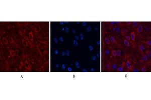 anti-alpha-Methylacyl-CoA Racemase (AMACR) antibody