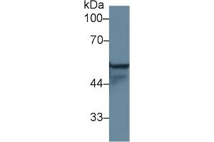 Western Blot; Sample: Human A431 cell lysate; Primary Ab: 1µg/ml Rabbit Anti-Rat KRT4 Antibody Second Ab: 0. (KRT4 Antikörper  (AA 317-454))