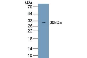 Detection of Recombinant WDR90, Human using Polyclonal Antibody to WD Repeat Containing Domain Protein 90 (WDR90) (WDR90 Antikörper  (AA 1-235))