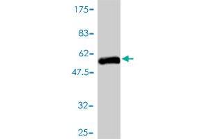 Western Blot detection against Immunogen (49. (RGS19 Antikörper  (AA 1-217))