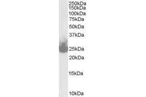 Western Blotting (WB) image for Synaptosomal-Associated Protein, 25kDa (SNAP25) peptide (ABIN368831) (Synaptosomal-Associated Protein, 25kDa (SNAP25) Peptid)