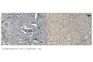 IHC analysis of MCM5 using anti-MCM5 antibody (ABIN7600583). (MCM5 Antikörper  (AA 206-723))