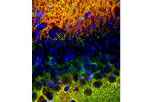 Immunohistochemistry (IHC) image for anti-SynCAM 1/2/3 (AA 436-446) antibody (ABIN1742491) (SynCAM 1/2/3 (AA 436-446) Antikörper)