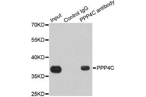 Immunoprecipitation analysis of 200ug extracts of 293T cells using 1ug PPP4C antibody. (PPP4C Antikörper)