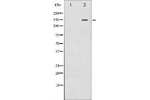 Western blot analysis of iNOS phosphorylation expression in whole cell lysates,The lane on the left is treated with the antigen-specific peptide. (NOS2 Antikörper  (pTyr151))