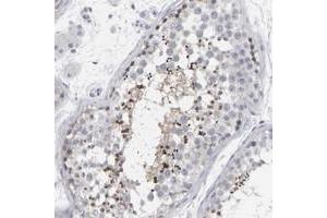 Immunohistochemical staining of human testis with C9orf11 polyclonal antibody  shows strong cytoplasmic positivity in a subset of seminiferus duct cells. (C9orf11 Antikörper)