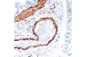 Immunohistochemistry of paraffin-embedded rat lung using α-Actin-1  Rabbit mAb (ABIN1682816, ABIN7101454, ABIN7101455 and ABIN7101456) at dilution of 1:100 (40x lens). (Actin (Alpha-Actin) Antikörper)