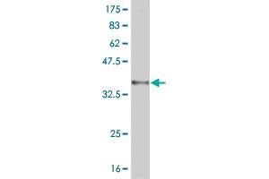 Western Blot detection against Immunogen (36. (RNF122 Antikörper  (AA 61-155))