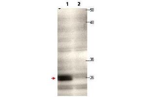 Western blot using  protein A purified anti-CENP-Q antibody shows detection of endogenous CENP-Q in a HeLa whole cell lysate (lane 1, arrowhead). (CENPQ Antikörper)