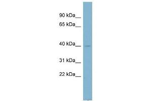 NDUFA9 antibody used at 1 ug/ml to detect target protein. (NDUFA9 Antikörper)