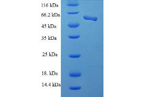 SDS-PAGE (SDS) image for Casein Kinase 2 alpha 1 (CSNK2A1) (AA 8-350), (partial) protein (His-SUMO Tag) (ABIN5711209)