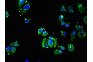 Immunofluorescent analysis of MCF-7 cells using ABIN7145429 at dilution of 1:100 and Alexa Fluor 488-congugated AffiniPure Goat Anti-Rabbit IgG(H+L) (ADRB3 Antikörper  (AA 1-36))